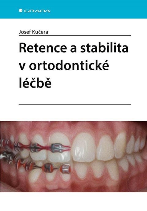 Kučera Josef: Retence a stabilita v ortodontické léčbě Kučera Josef: Retence a stabilita v ortodontické léčbě
