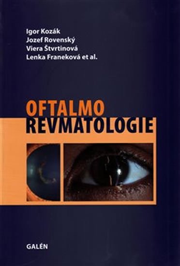 Kozák Igor: Oftalmorevmatologie