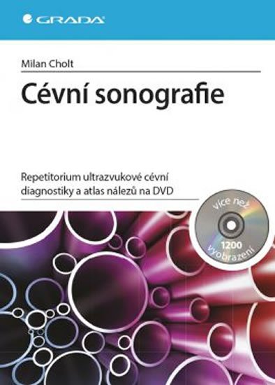 Cholt Milan: Cévní sonografie - repetitorium ultrazvukové cévní diagnostiky a atlas nále Cholt Milan: Cévní sonografie - repetitorium ultrazvukové cévní diagnostiky a atlas nále
