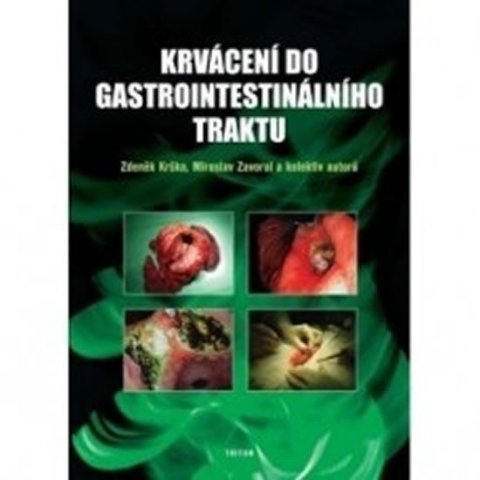 Krška Zdeněk: Krvácení do gastrointestinálního traktu