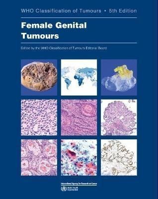 kolektiv autorů: Female Genital Tumours: WHO Classification of Tumours (Medicine) 5th Editio