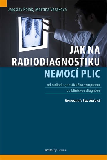 Polák Jaroslav, Vašáková Martina: Jak na radiodiagnostiku nemocí plic Polák Jaroslav, Vašáková Martina: Jak na radiodiagnostiku nemocí plic