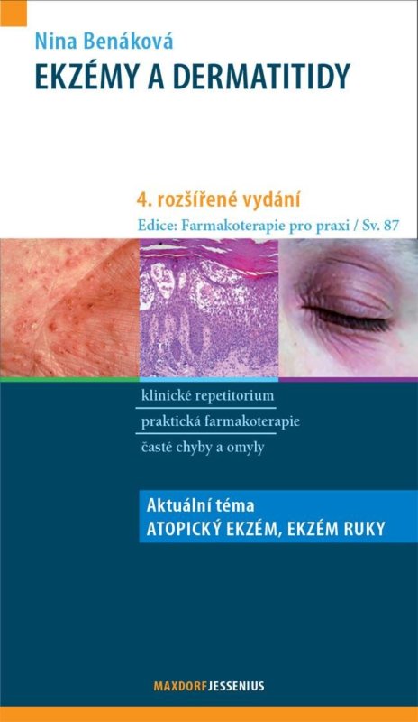 Benáková Nina: Ekzémy a dermatitidy Benáková Nina: Ekzémy a dermatitidy