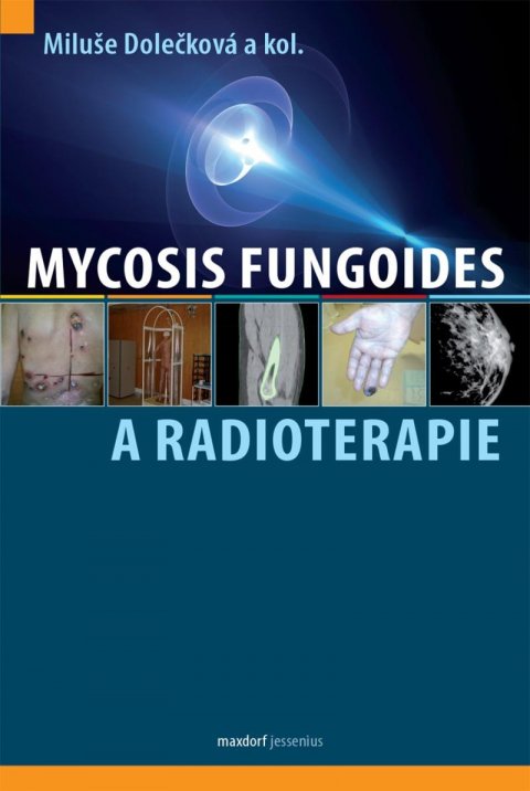 kolektiv autorů: Mycosis fungoides a radioterapie