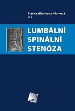 Mičánková Adamová Blanka: Lumbální spinální stenóza