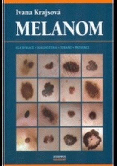 Krajsová Ivana: Melanom Krajsová Ivana: Melanom
