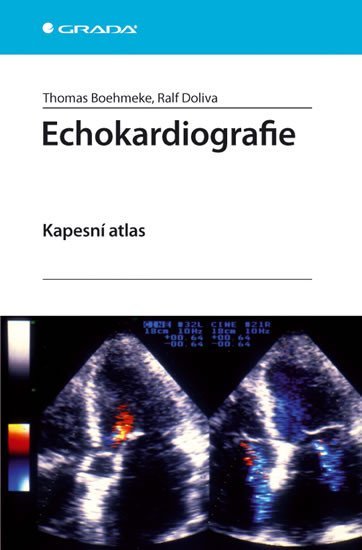 Böhmeke Thomas: Echokardiografie