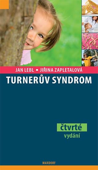 Lebl Jan: Turnerův syndrom