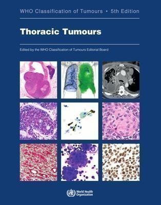 kolektiv autorů: Thoracic tumours: WHO Classification of Tumours (Medicine) 5th Edition