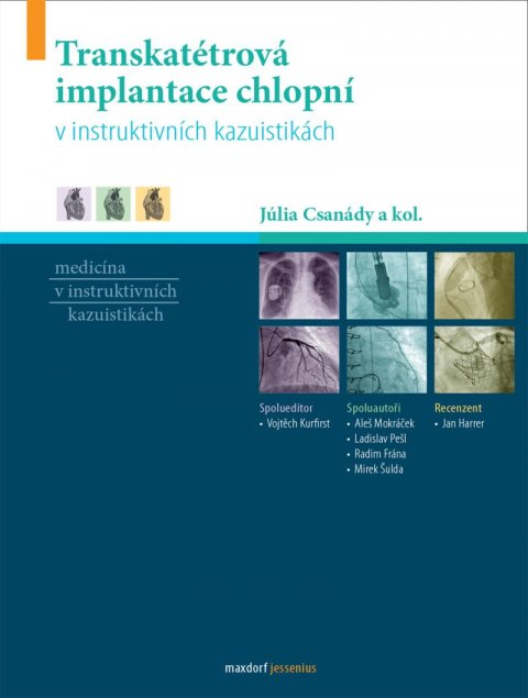 Csanády Júlia: Transkatétrová implantace chlopní v instruktivních kazuistikách