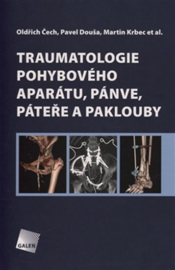 Čech Oldřich: Traumatologie pohybového aparátu, pánve, páteře a paklouby