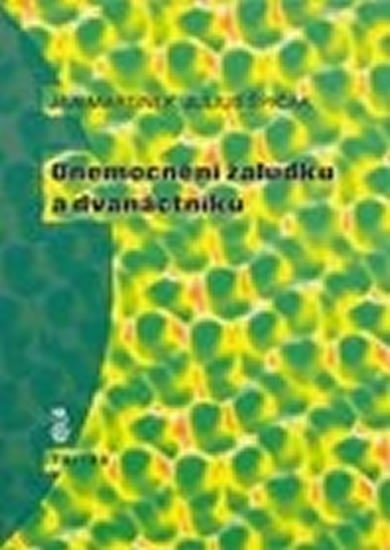 Martínek Jan: Onemocnění žaludku a dvanáctníku