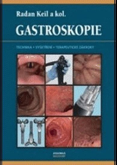Keil Radan a kolektiv: Gastroskopie Keil Radan a kolektiv: Gastroskopie