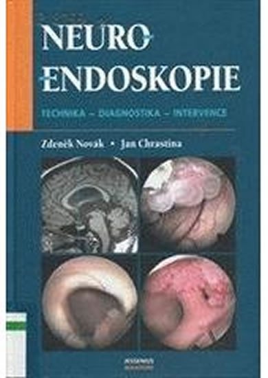 Novák Zdeněk, Chrastina Jan,: Neuroendoskopie Novák Zdeněk, Chrastina Jan,: Neuroendoskopie