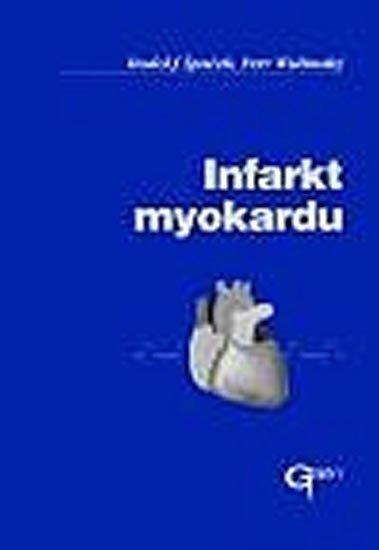 Widimský Petr: Infarkt myokardu