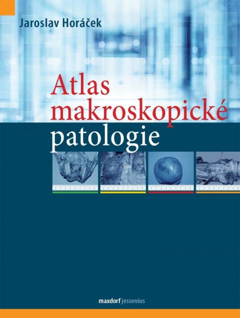 Horáček Jaroslav: Atlas makroskopické patologie Horáček Jaroslav: Atlas makroskopické patologie