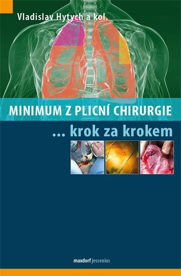 Hytych Vladislav a kolektiv: Minimum z plicní chirurgie krok za krokem Hytych Vladislav a kolektiv: Minimum z plicní chirurgie krok za krokem
