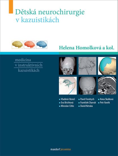 Homolková Helena a kolektiv: Dětská neurochirurgie v kazuistikách