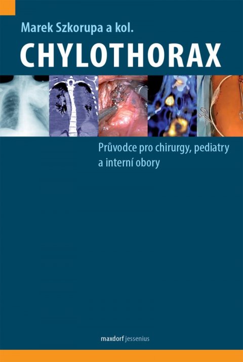 Szkorupa Marek: Chylothorax - Průvodce pro chirurgy, pediatry a interní obory