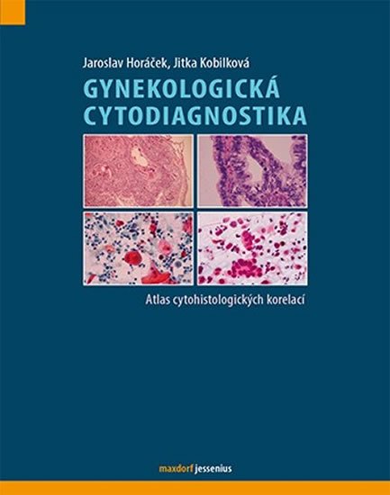 Horáček Jaroslav, Kobilková Jitka: Gynekologická cytodiagnostika - Atlas cytohistologických korelací Horáček Jaroslav, Kobilková Jitka: Gynekologická cytodiagnostika - Atlas cytohistologických korelací