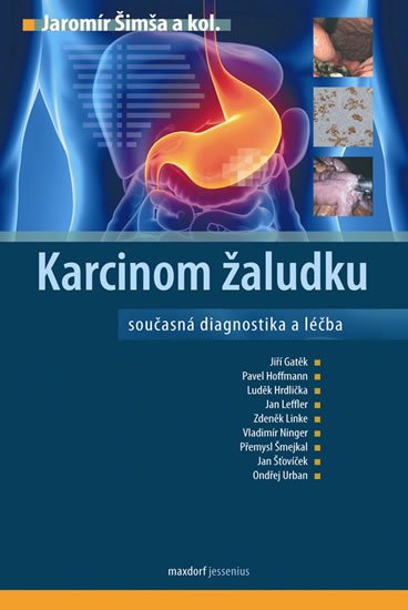Šimša Jaromír a kolektiv: Karcinom žaludku Šimša Jaromír a kolektiv: Karcinom žaludku