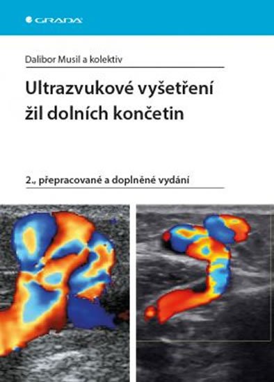 Musil Dalibor: Ultrazvukové vyšetření žil dolních končetin