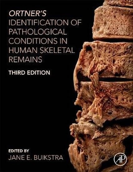 Buikstr Jane E.: Ortner's Identification of Pathological Conditions in Human Skeletal Re Buikstr Jane E.: Ortner's Identification of Pathological Conditions in Human Skeletal Re