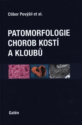 Povýšil Ctibor: Patomorfologie chorob kostí a kloubů