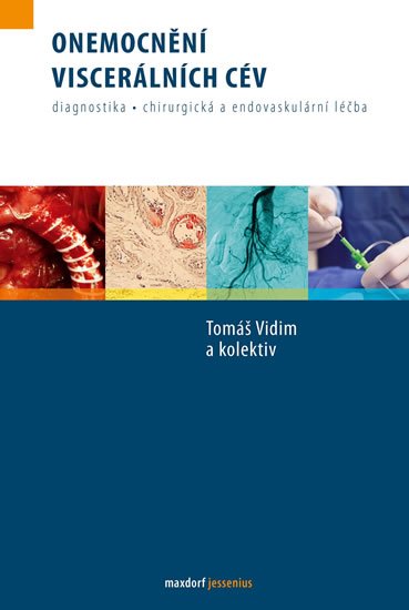 Vidim a kolektiv Tomáš: Onemocnění viscerálních cév Vidim a kolektiv Tomáš: Onemocnění viscerálních cév