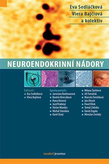 Sedláčková Eva: Neuroendokrinní nádory Sedláčková Eva: Neuroendokrinní nádory