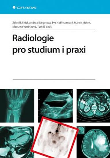 Seidl Zdeněk: Radiologie pro studium i praxi Seidl Zdeněk: Radiologie pro studium i praxi