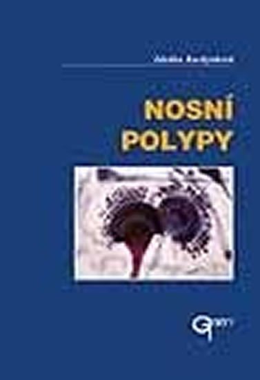 Kuchynková Zdeňka: Nosní polypy