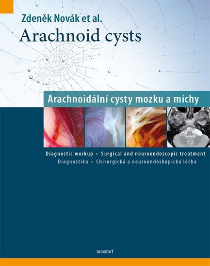 Novák Zdeněk: Arachnoid cysts - Arachnoidální cysty mozku a míchy Novák Zdeněk: Arachnoid cysts - Arachnoidální cysty mozku a míchy