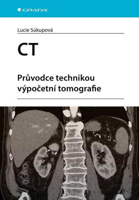 Súkupová Lucie: CT - Průvodce technikou výpočetní tomografie