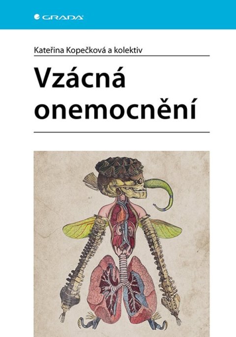 Kopečková Kateřina: Vzácná onemocnění