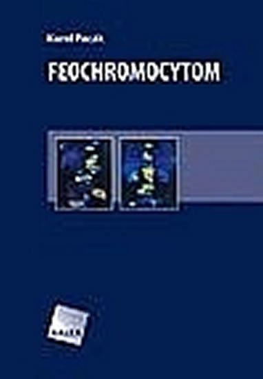 Pacák Karel: Feochromocytom