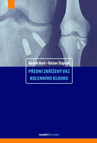 Hart Radek: Přední zkřížený vaz kolenního kloubu