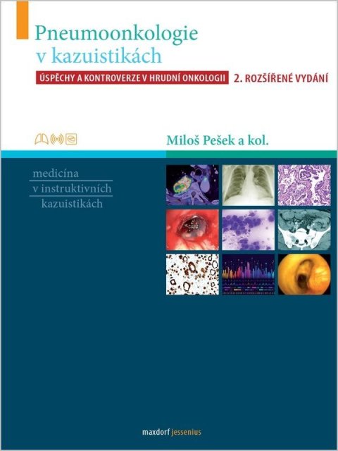 : Pneumoonkologie v kazuistikách - Úspěchy a kontroverze v hrudní chirurgii