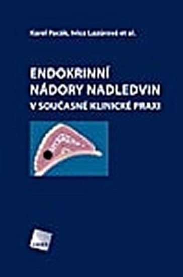 Lazúrová Ivica: Endokrinní nádory nadledvin v současné klinické praxi
