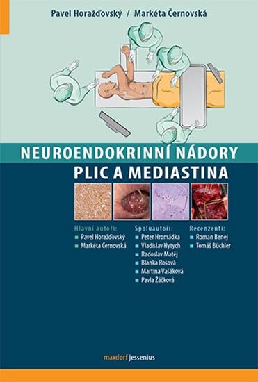 Horažďovský Pavel, Černovská Markéta: Neuroendokrinní nádory plic a mediastina Horažďovský Pavel, Černovská Markéta: Neuroendokrinní nádory plic a mediastina