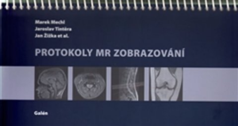 kolektiv autorů: Protokoly MR Zobrazování