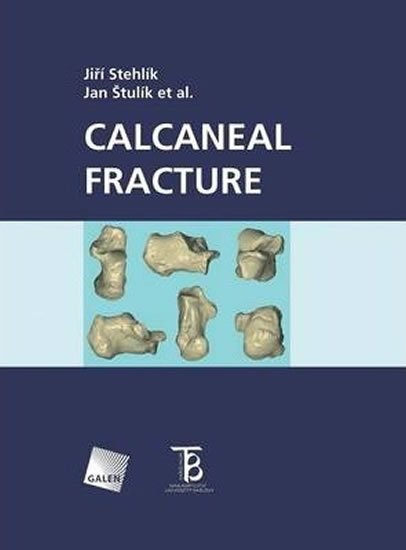 Štulík Jan: Calcaneal fracture