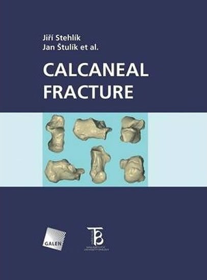 Štulík Jan: Calcaneal fracture Štulík Jan: Calcaneal fracture