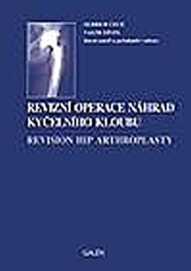Krbec Martin: Revizní operace náhrad kyčelního kloubu