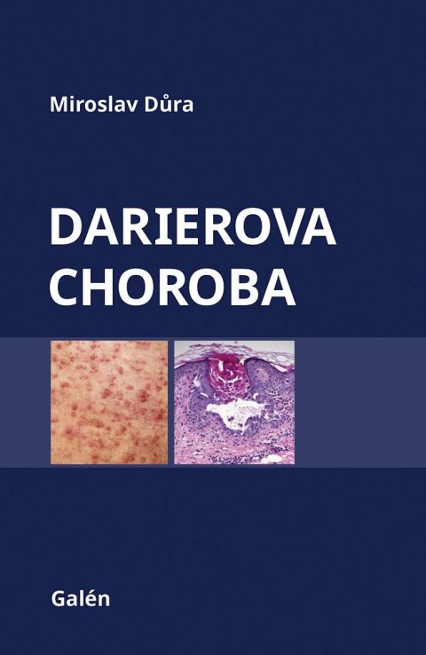 Důra Miroslav: Darierova choroba