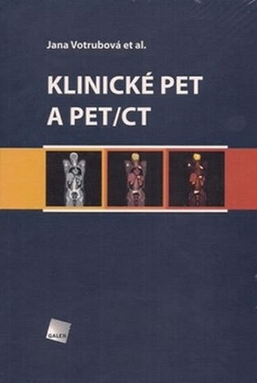 Votrubová Jana: Klinické PET a PET/CT