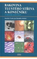 kolektiv autorů: Rakovina tlustého střeva a konečníku - vybrané kapitoly