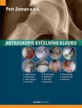 Zeman Petr: Artroskopie kyčelního kloubu