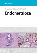 kolektiv autorů: Endometrióza