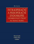 Stašek Martin: Intraoperační a perioperační endoskopie a kombinované výkony na trávicí tru
